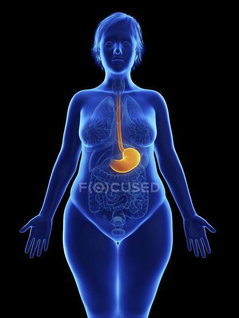 Frontal illustration of blue silhouette of obese woman with highlighted stomach on black background. — Stock Photo