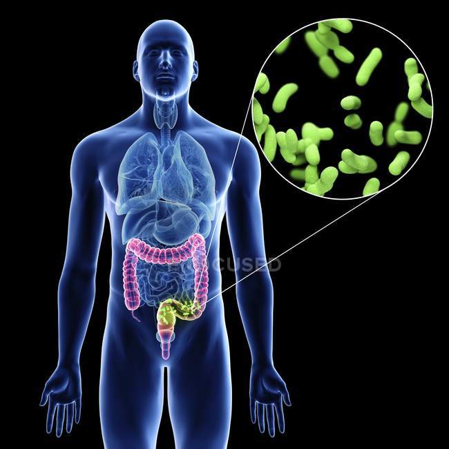 Illustration of colon infection bacteria in male body silhouette on black background. — Stock Photo