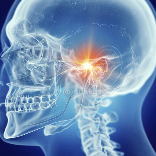 Illustration of painful temporomandibular joint in human skeleton. — Stock Photo