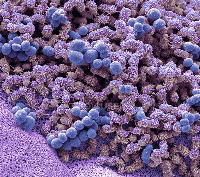 Scanning electron micrograph of Brevibacteria on human feet causing odour. — Stock Photo