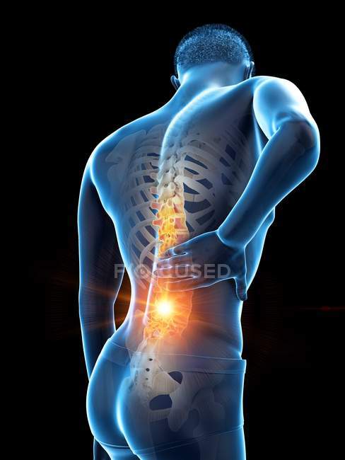 Male silhouette with back pain on black background, conceptual illustration. — Stock Photo