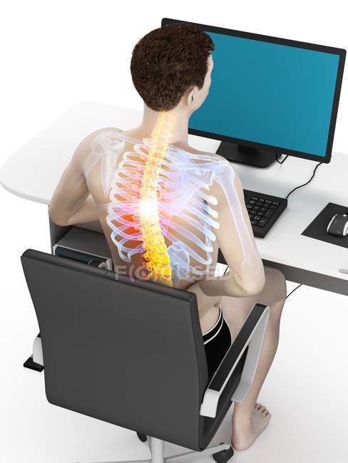 Office worker with back pain in high angle view, conceptual illustration. — Stock Photo