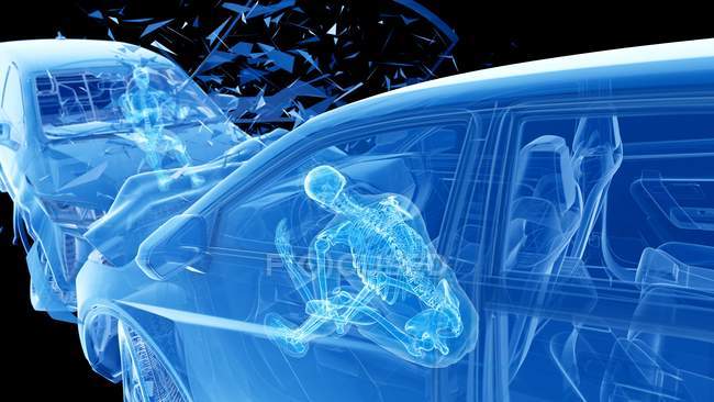 X-ray illustration of risk of injury while head-on car crash, digital artwork. — Stock Photo