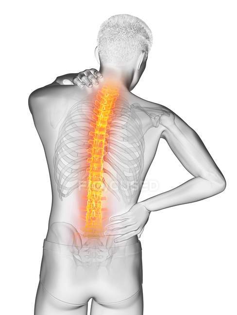 Male silhouette with back pain, conceptual illustration. — Stock Photo