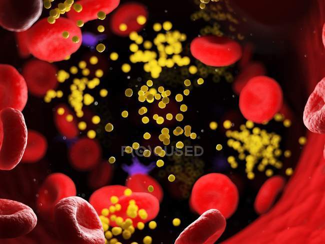 Fat in blood cells blocking blood vessel, digital illustration. — Stock Photo