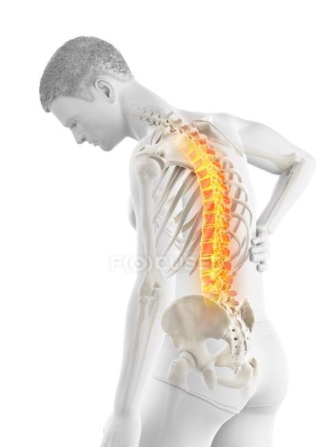 Bending male silhouette with back pain, conceptual illustration. — Stock Photo