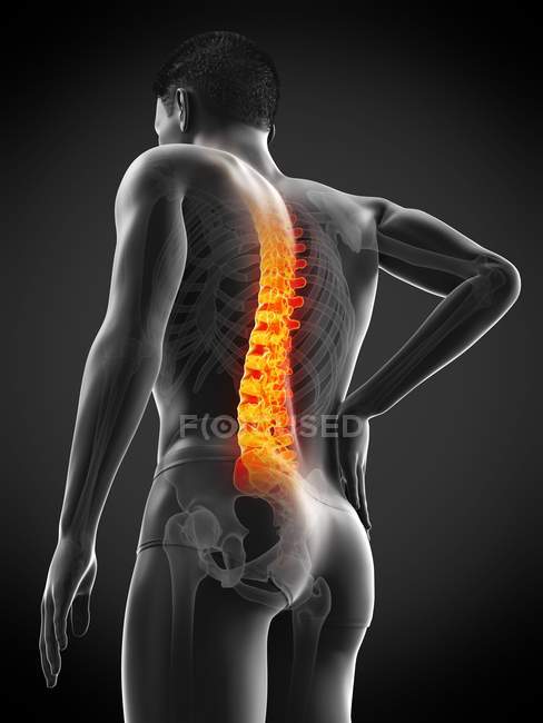 Male silhouette with back pain in low angle view, conceptual illustration. — Stock Photo