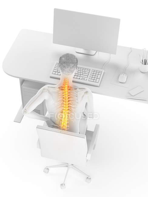 Office worker with back pain due to sitting in high angle view, digital illustration. — Stock Photo