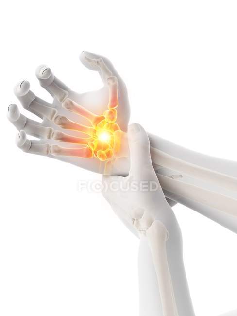 Male hands with glowing wrist pain, conceptual illustration. — Stock Photo