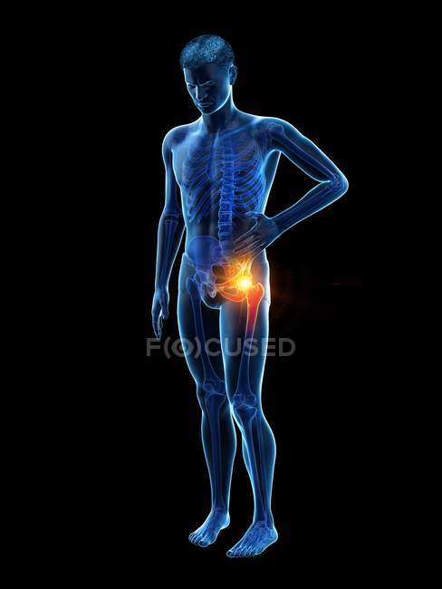 Silhouette of man having hip pain, digital illustration. — Stock Photo