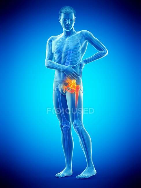 Silhouette of man having hip pain, digital illustration. — Stock Photo