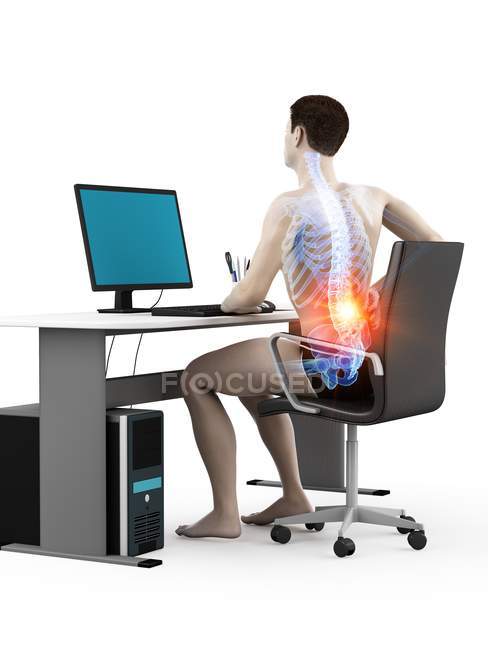 Office worker silhouette sitting at desk with back pain, conceptual illustration. — Stock Photo