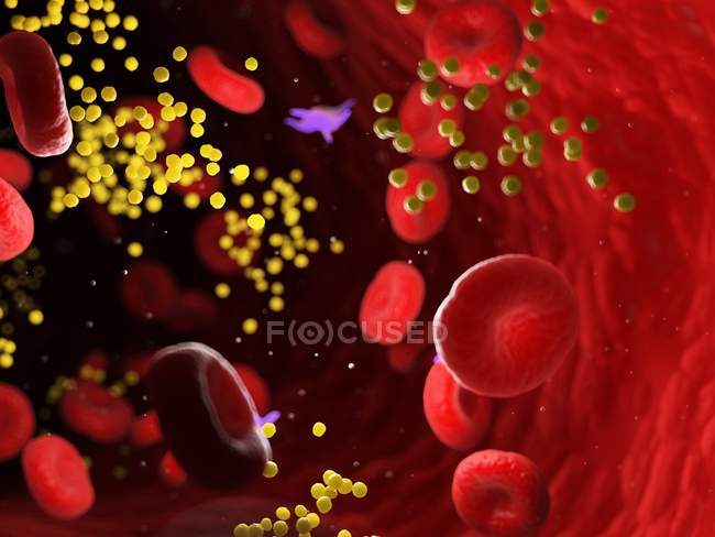 Fat in blood cells blocking blood vessel, digital illustration. — Stock Photo