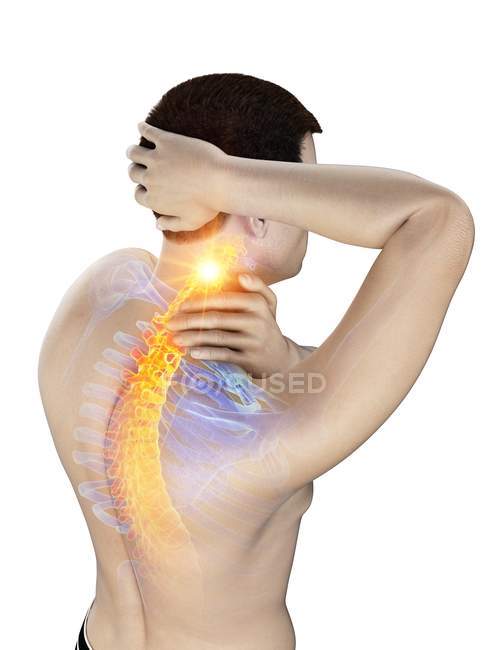 Male body with visible neck pain, conceptual illustration. — Stock Photo