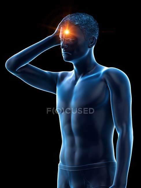 Man with headache, conceptual medical illustration. — Stock Photo