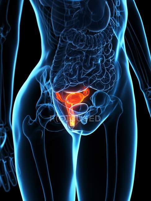 Diseased uterus in female body, digital illustration. — Stock Photo