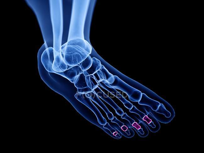 Middle phalanx bones in x-ray computer illustration of human foot. — Stock Photo