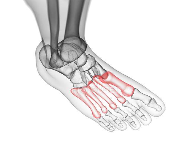 Metatarsal bones in x-ray computer illustration of human foot. — Stock Photo