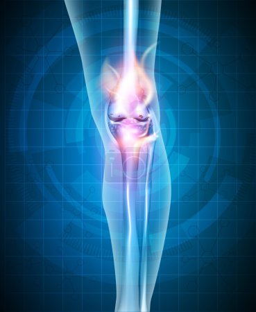 Illustration for Burning knee, painful knee concept. Abstract blue technology background. - Royalty Free Image