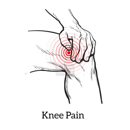 Illustration for Painted knee pain. Discomfort in a joint leg. Symptoms of motor functions in humans. It is difficult to walk. Vector sketch illustration legs. Hands hold the knee in place of pain. Illustration knee - Royalty Free Image