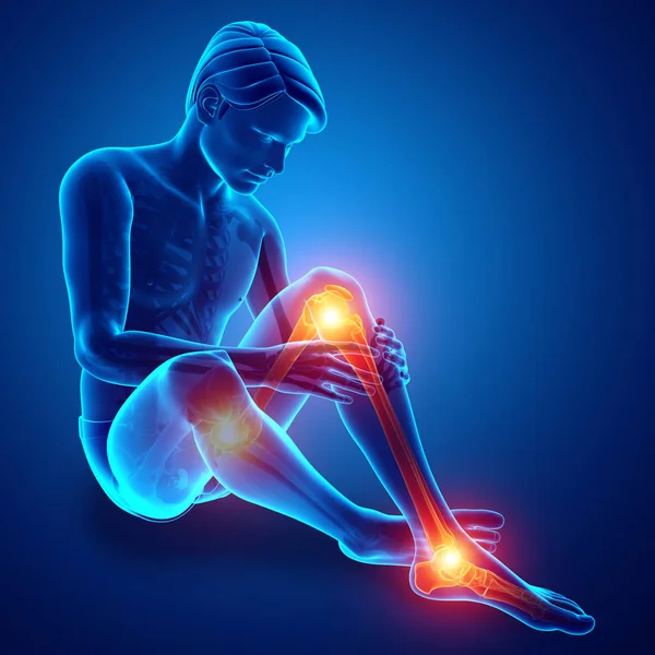 Male Leg Joint Pain