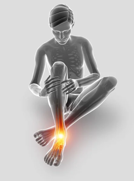 3d Illustration of Male foot with ankle pain