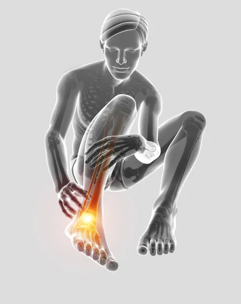 3d Illustration of Male foot with ankle pain