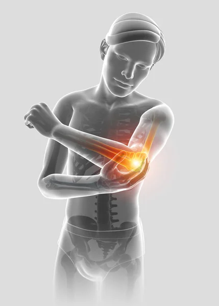 3d Illustration of Male Feeling Elbow pain