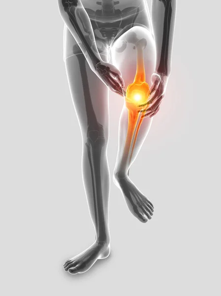 3d Illustration of Male feeling Knee pain