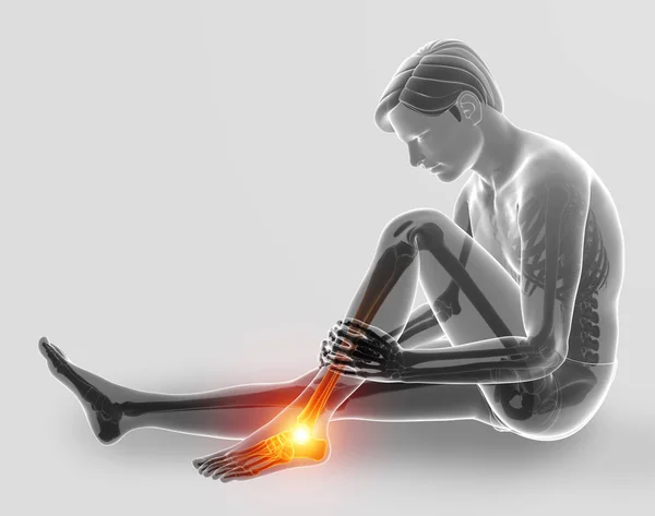 3d Illustration of Male foot with ankle pain