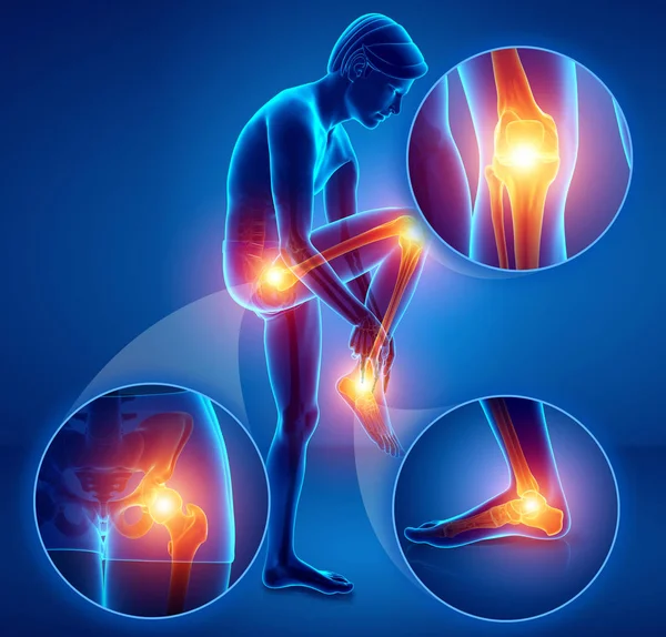 3d Illustration of male feeling Leg pain