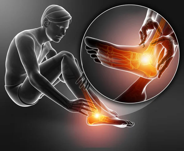 3d illustration of male foot with ankle pain