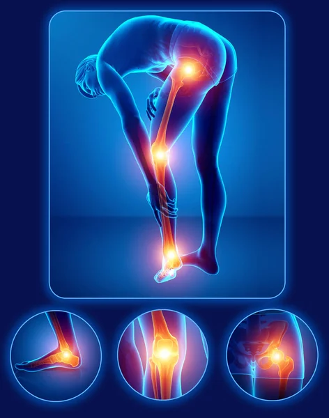 3d Illustration of male feeling Leg pain