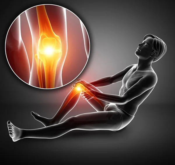 3d Illustration of Male feeling Knee pain