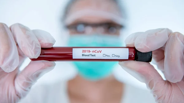 Healthcare to aid recovery from COVID-19. Scientist wear surgical gloves and mask with a coronavirus infected blood sample test. Asian woman doctor biohazard protection clothing