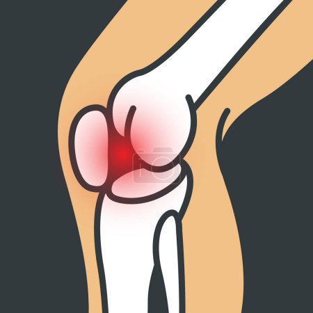 Illustration for Knee Pain vector logo icon illustrator - Royalty Free Image