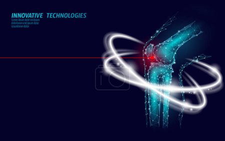 Illustration for Human knee joint 3d model vector illustration. Low poly design future technology cure pain treatment. Blue background and red injury man body leg medicine template. - Royalty Free Image