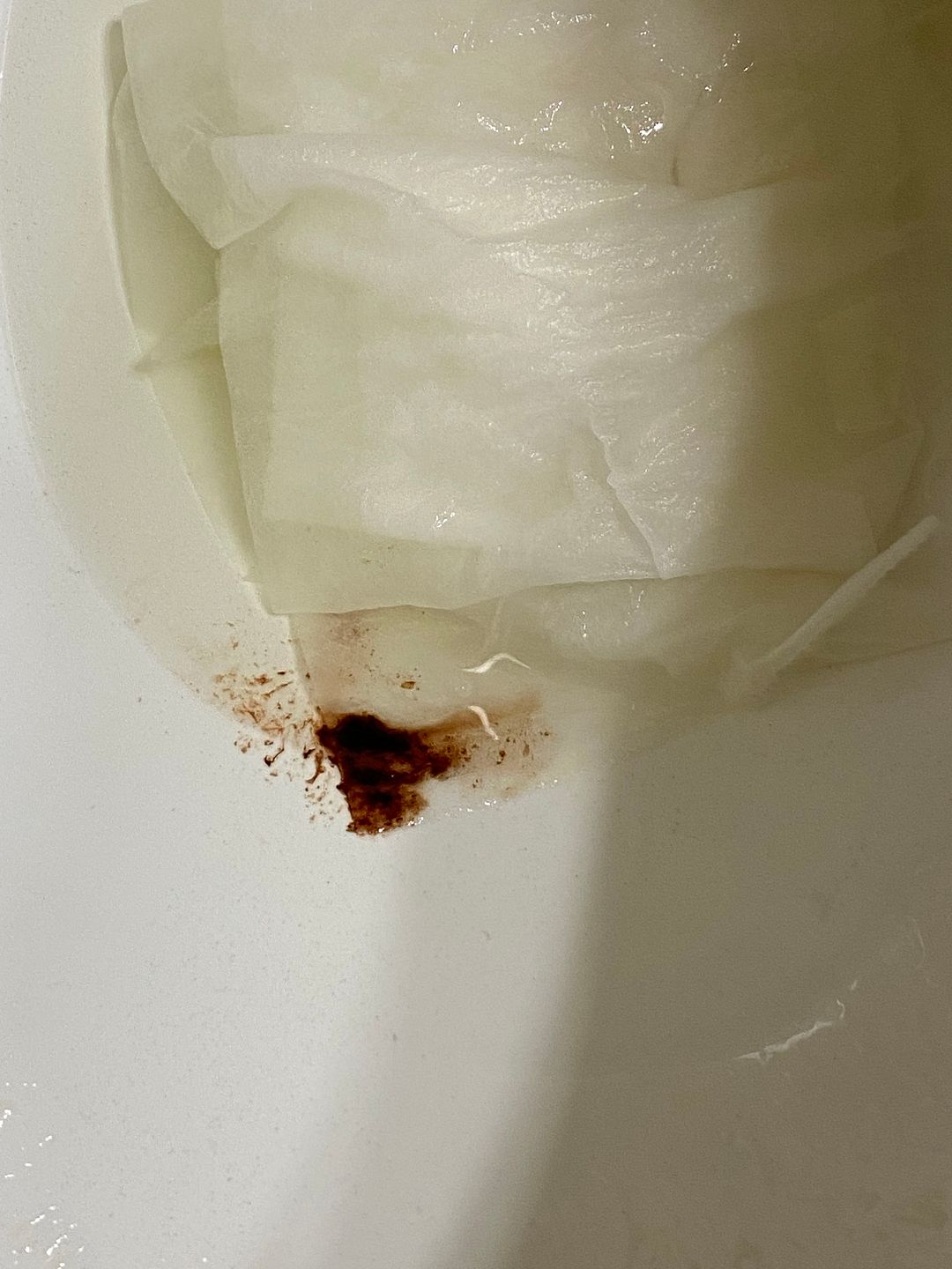 Is This Implantation Bleeding Or Miscarriage Babycent - vrogue.co