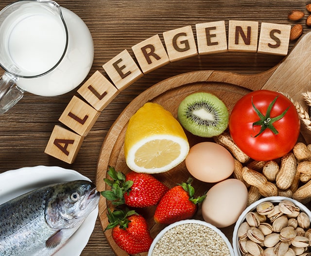 food allergies 