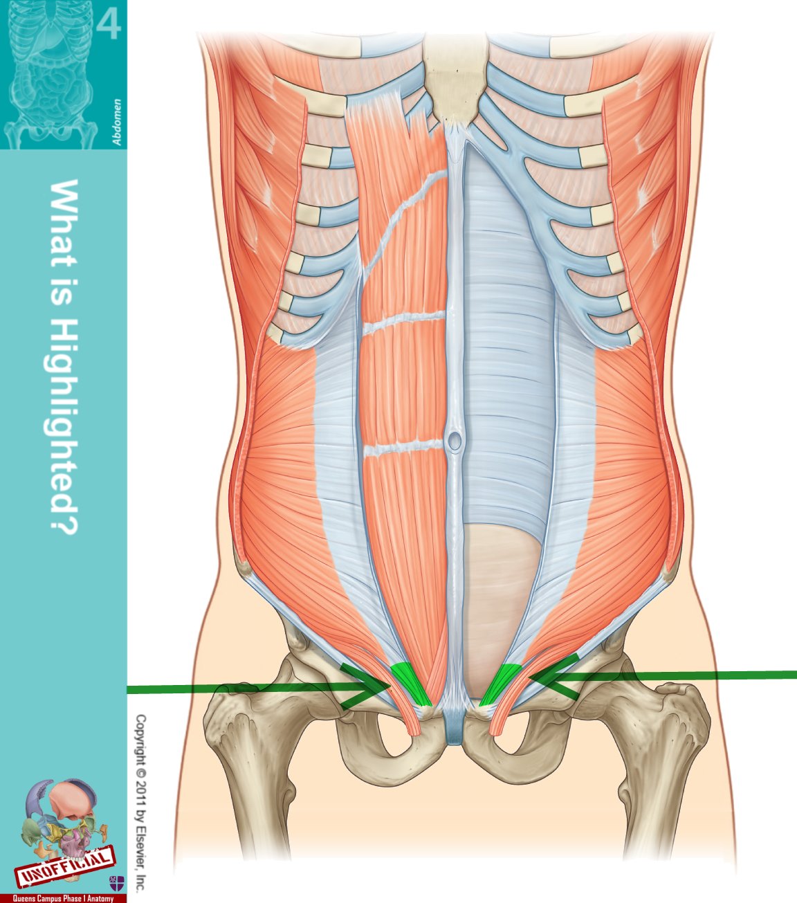 Conjoint Tendon Shoulder Anatomy Posterior View Of Th - vrogue.co