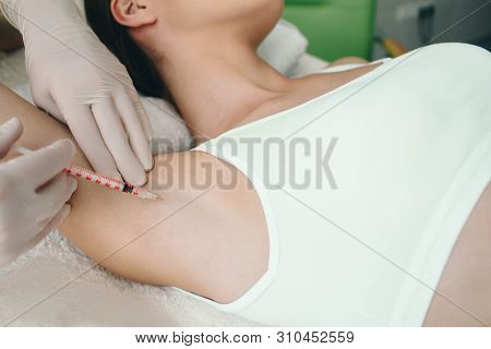 Woman Receives An Underarm Treatment, Hyperhidrosis. Armpit Injections To Prevent Excessive Sweating