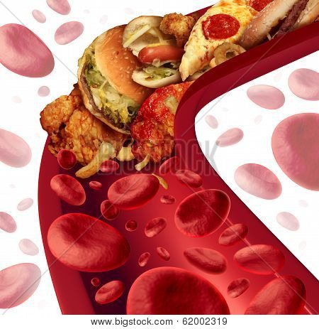 Cholesterol Blocked Artery