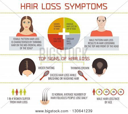 Hair loss symptoms infographic elements. Female and male pattern hair loss set. Hair care concept. Hair loss clinic concept design. Vector illustration.