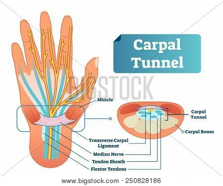 Carpal Tunnel Vector Illustration Scheme. Medical Labeled Diagram Closeup With Isolated Muscle, Tran