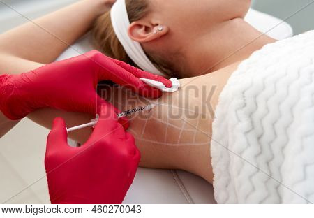 Doctor Makes Injections Of Botulinum Toxin In The Underarm Area Against Hyperhidrosis In Beauty Salo