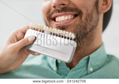 medicine, dentistry and healthcare concept - close up of dentist with tooth color samples choosing shade for male patient teeth at dental clinic