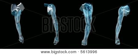 Anatomie ein Arm X-Ray