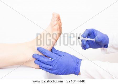 The Doctor Injects The Patient In The Foot Area Of The Sole Against Hyperhidrosis, Excessive Sweatin