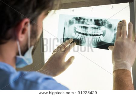 Closeup of dentist looking at dental x-ray plate
