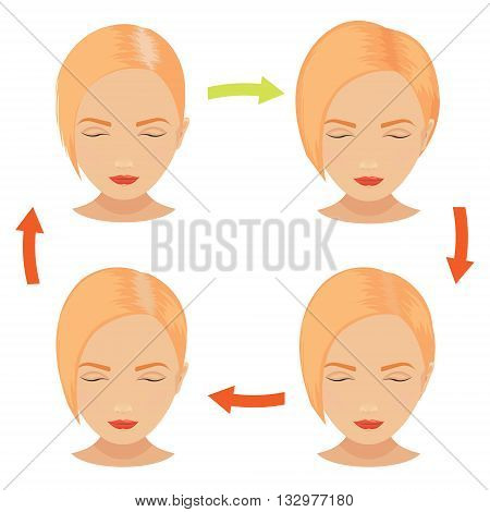 Female hair loss stages set. Blond woman before and after hair treatment and hair transplantation. Female pattern baldness. Implantation of hair. Vector illustration.